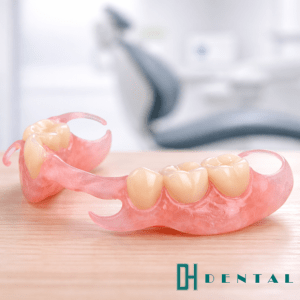 Prothese Valplast chez DH Dental
